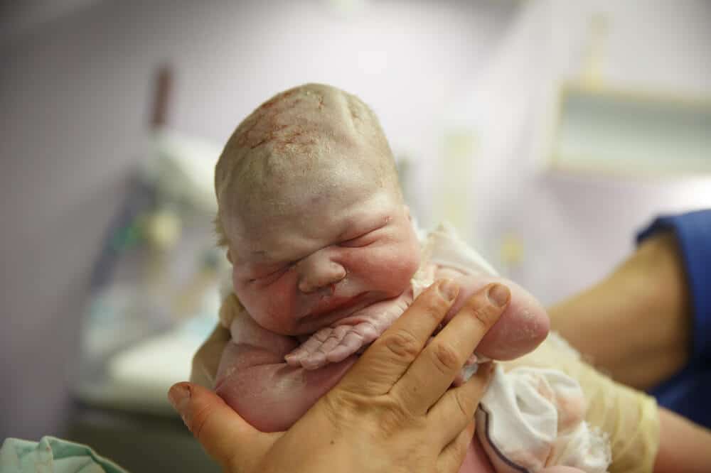 Baby wenige Sekunden nach der Geburt