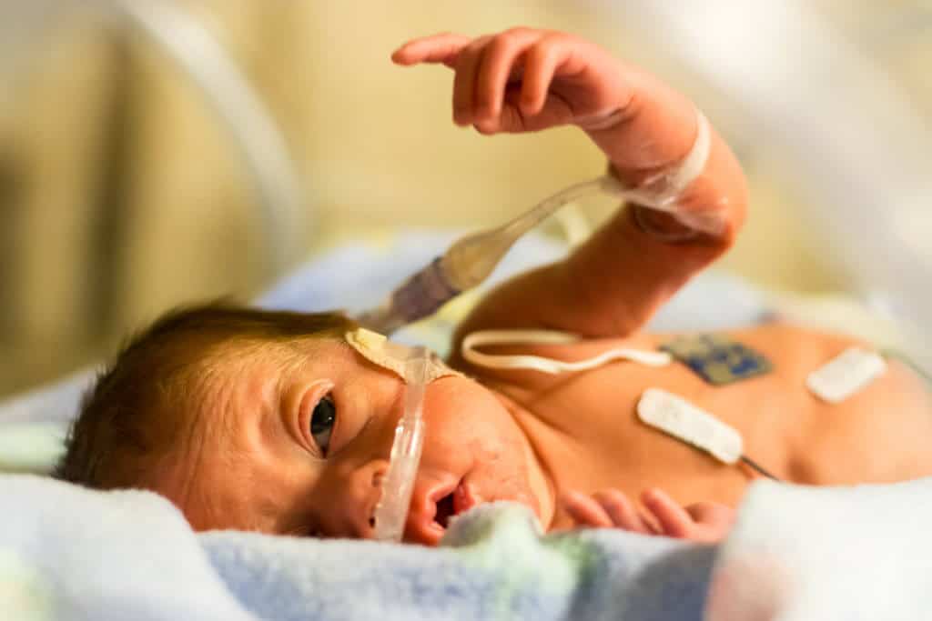 Frühchen Baby in einem Brutkasten an Schläuchen angeschlossen