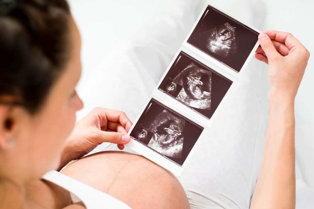 Schwangerschaft - Schwangere schaut sich Ultraschallaufnahmen an