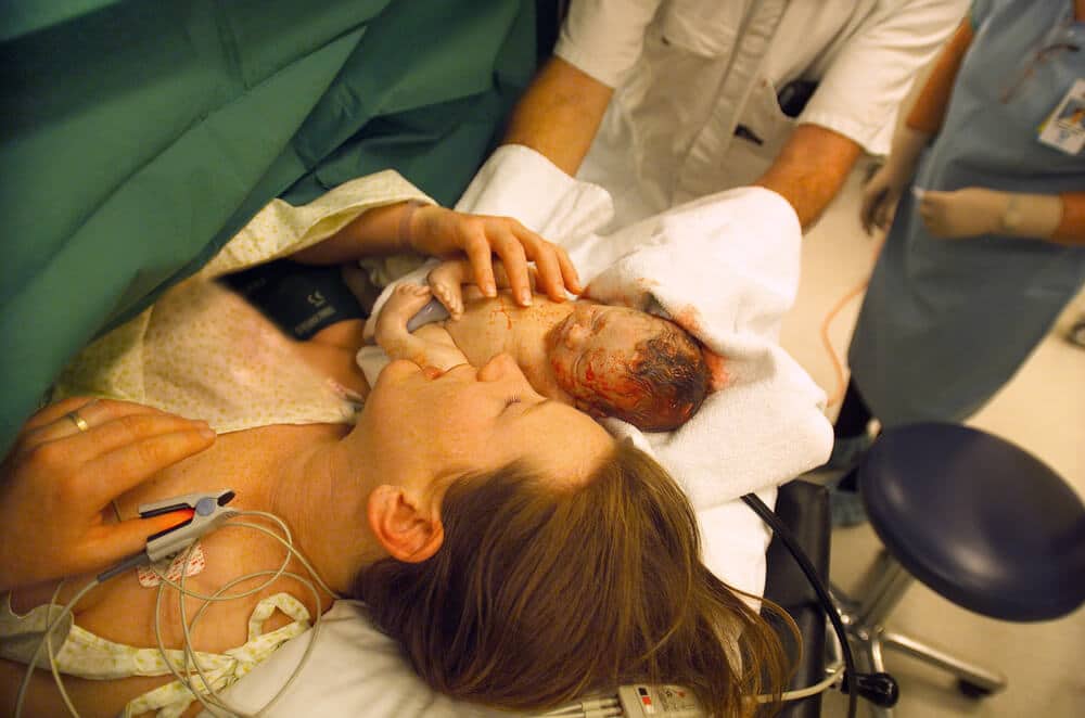 Kaiserschnitt Mutter mit Baby auf dem OP Tisch im Kreissaal