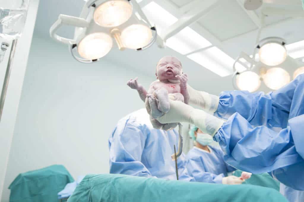 Kaiserschnitt Neugeborenes im Kreissaal