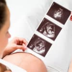 Schwangerschaft - Schwangere schaut sich Ultraschallaufnahmen an