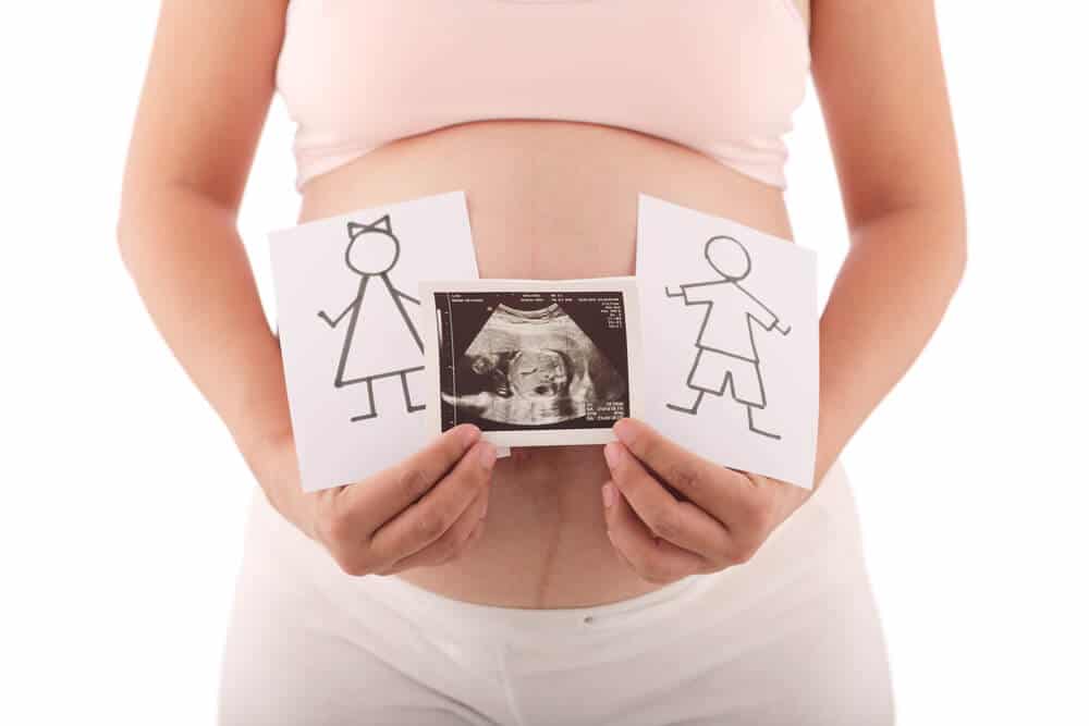 Geschlechterbestimmung - Mutter mit Ultraschallbild vor dem Bauch