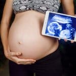 Ultraschallgeräte Schwangere mit Ultraschallbild auf Tablett