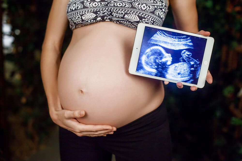 Ultraschallgeräte Schwangere mit Ultraschallbild auf Tablett