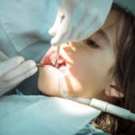 Kreidezähne – Ein Interview mit dem Zahnarzt Dr. Dr. Andreas Dorow