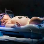 Neugeborenengelbsucht: Foto- bzw. Lichttherapie