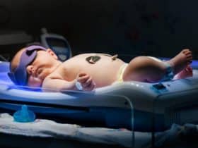 Neugeborenengelbsucht: Foto- bzw. Lichttherapie