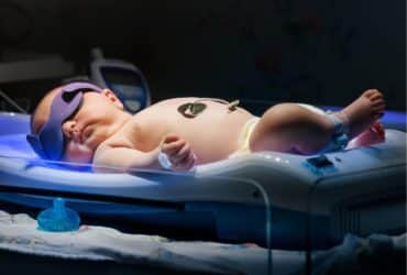 Neugeborenengelbsucht: Foto- bzw. Lichttherapie
