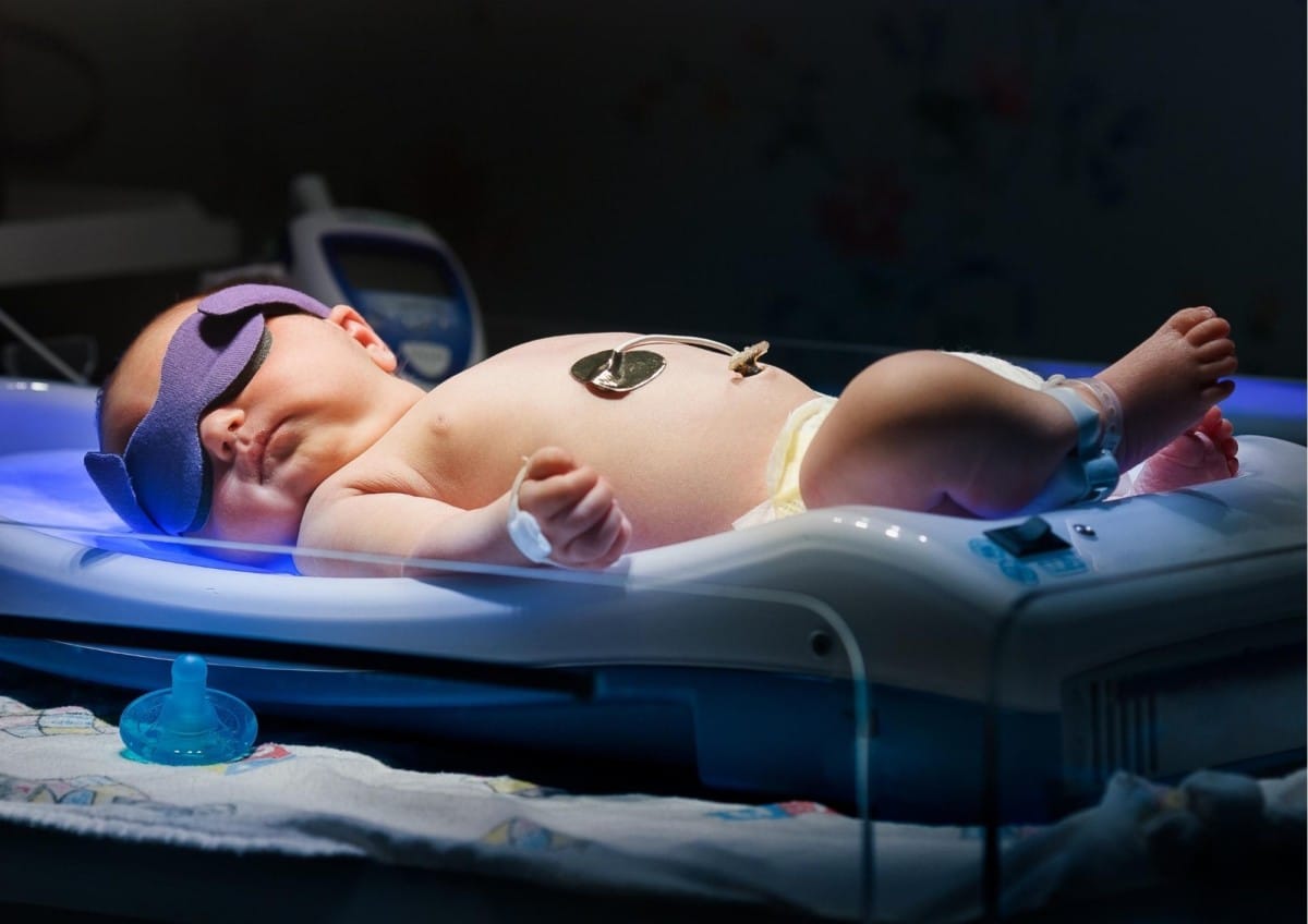 Neugeborenengelbsucht: Foto- bzw. Lichttherapie